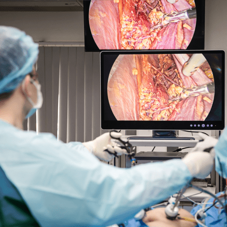 3D Laparoscopic Surgery